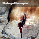 Blutegeltherapie